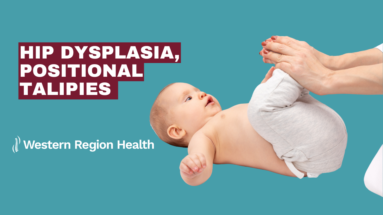 Hip Dysplasia, Positional Talipies - Western Region Health